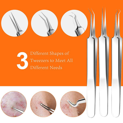 Pimple Popper Tool Kit, 15 PCS Blackhead Remover Comedone Acne Extractor Tools, Professional Sharp Stainless Skin Blemish Removal Pimple Tools with Metal Case
